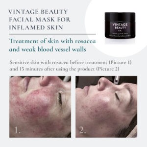 Facial Mask Inflamed Skin before-after 3