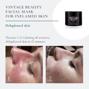 Facial Mask Inflamed Skin before-after 1