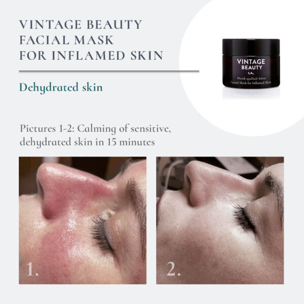 Facial Mask Inflamed Skin before-after 1