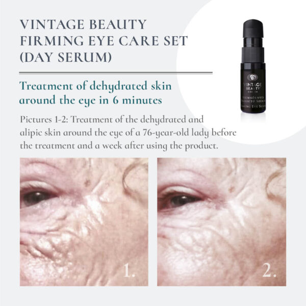 Firming Eye Serum before-after
