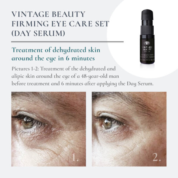 Firming Eye Serum before-after