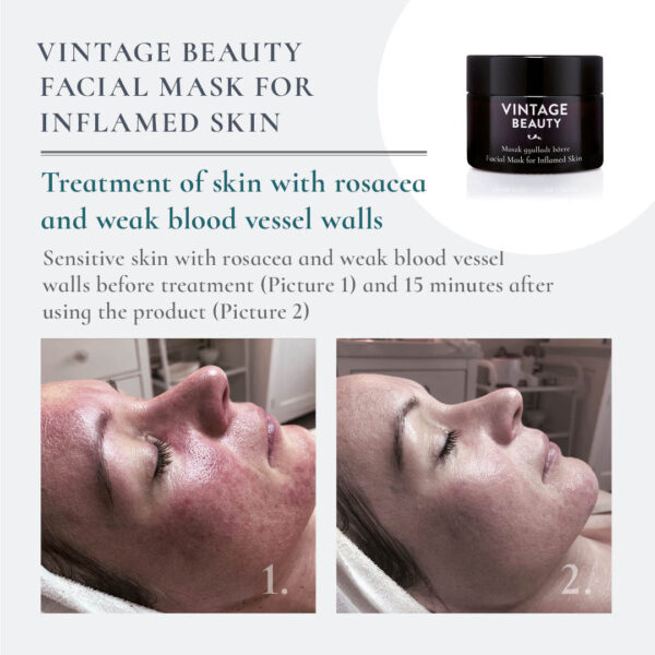 Facial Mask Inflamed Skin before-after 2