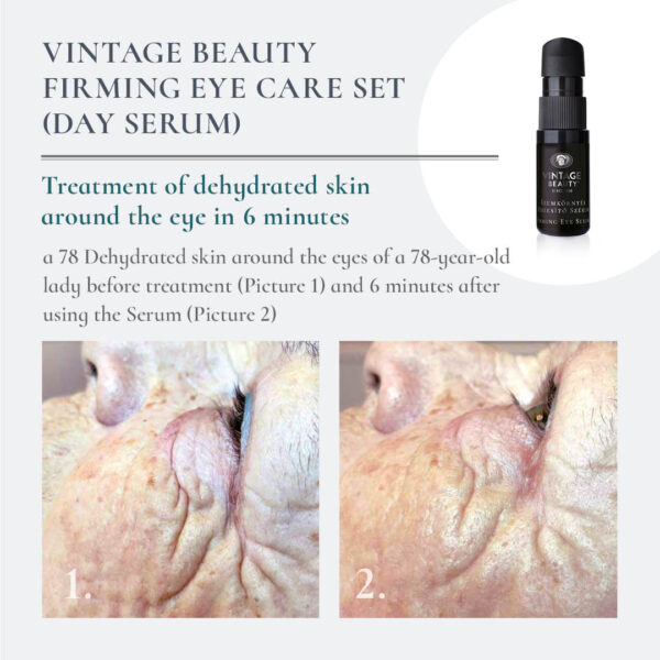 Firming Eye Serum before-after